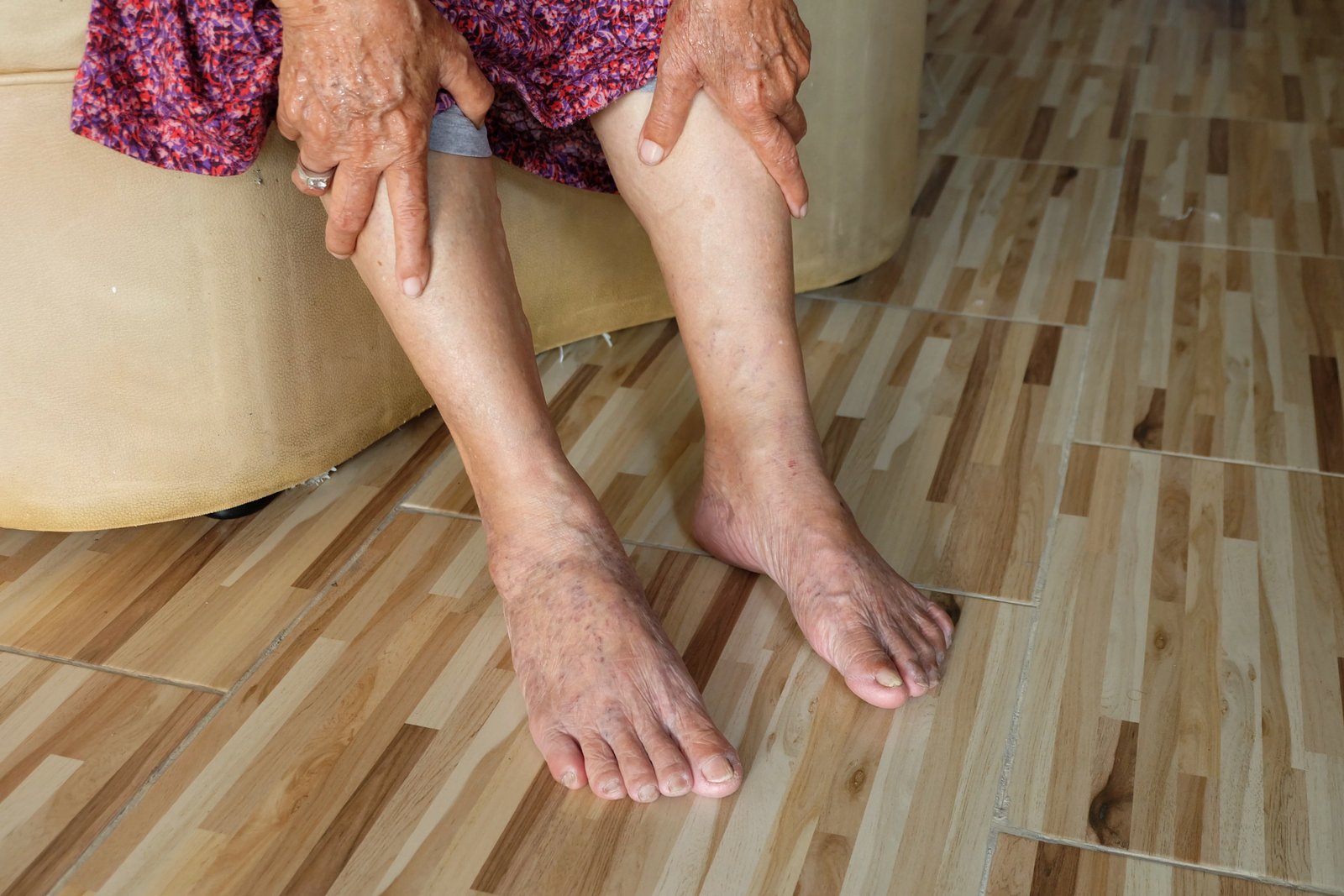 Asian old woman holding a leg that pain from varicose veins on t